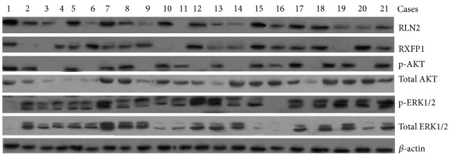 Western blot assay for RLN2.jpg